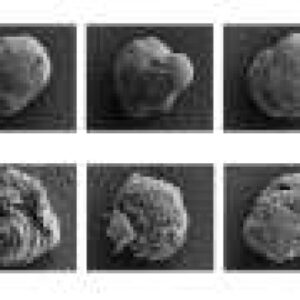 Cell ‘invisibility cloaks’ could offer side-effect-free diabetes treatment