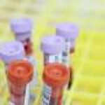 Organs age at different speeds: A blood test might soon tell which ones