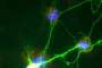 High-speed microscopy reveals electrical activity across the brain