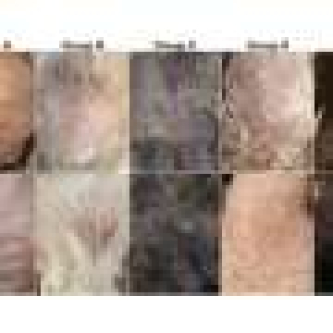 Topical clove oil for canine sarcoptic mange promises faster, plant-based treatment