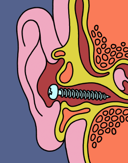 For People with Misophonia, Everyday Noises Can Be Agony