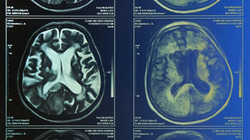 Want to Make Better Decisions? A New Study Shows How Your Brain Chooses Which Signals Matter