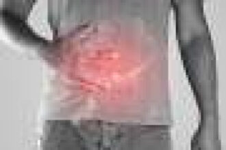 Lung disease more common with ulcerative colitis than Crohn’s disease