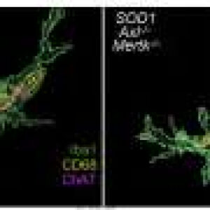 Microglia caught eating living motor neurons in ALS mice via unexpected immune pathway