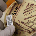 Alfalfa Sprouts Linked to 15-State Food-Poisoning Outbreak
