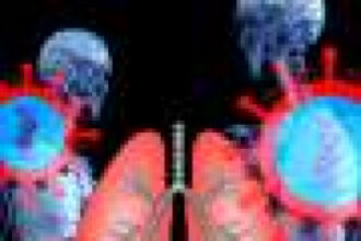 Younger adults with lung cancer more likely to have targetable genetic changes, study finds