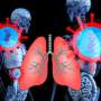 Younger adults with lung cancer more likely to have targetable genetic changes, study finds