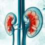 Short-term pretransplant dialysis does not affect kidney transplant outcomes