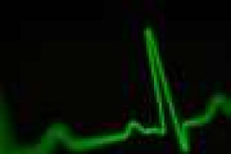 Implantable cardioverter-defibrillators may benefit certain younger patients with mild–moderate heart dysfunction