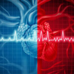 DOACs Benefit AF Patients With Intermediate Stroke Risk