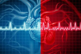 DOACs Benefit AF Patients With Intermediate Stroke Risk