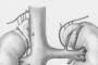 Monoclonal antibody targeting interleukin-6 achieves sustained reductions in inflammation biomarkers through six months