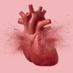 “Broken heart syndrome” can look just like a heart attack. This test can tell them apart