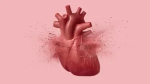 “Broken heart syndrome” can look just like a heart attack. This test can tell them apart