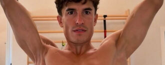 El brazo derecho Marc Márquez, una imagen impactante que vale más que mil palabras