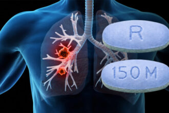Groundbreaking Pancreatic Cancer Drug Shows Promise in Lung Cancer