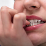 How gross is biting your fingernails?