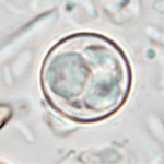 CDC reporting almost 20,000 confirmed patients in Cyclospora outbreak