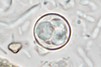 CDC reporting almost 20,000 confirmed patients in Cyclospora outbreak