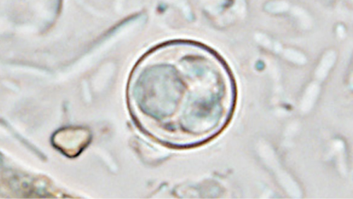 CDC reporting almost 20,000 confirmed patients in Cyclospora outbreak