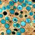 Protein shape shift reveals how the mpox virus begins replicating