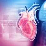 Who really needs a heart calcium scan?