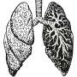 Combination therapy does not meet primary endpoints in first-line PD-L1-high metastatic non-small cell lung cancer