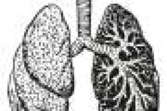 Combination therapy does not meet primary endpoints in first-line PD-L1-high metastatic non-small cell lung cancer