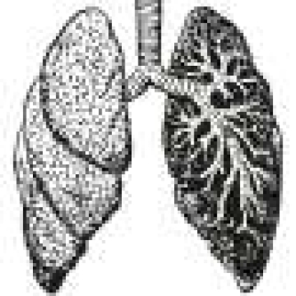 Combination therapy does not meet primary endpoints in first-line PD-L1-high metastatic non-small cell lung cancer