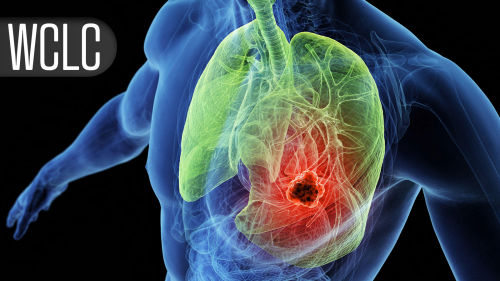 Significant Survival Boost With Novel ADCs  in Relapsed Small-Cell Lung Cancer