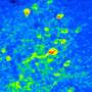 Learning reorganizes neural activity patterns to help distinguish important smells