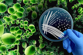 Multidrug-Resistant Yeast Often Transferred to Hospital Workers’ Gloves, Gowns