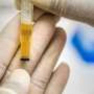 Simple urine test could guide kidney-protective treatment choices in type 2 diabetes