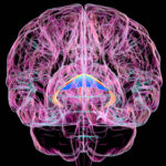 Brain Disorder Due to Vitamin Deficiency Often Goes Unrecognized