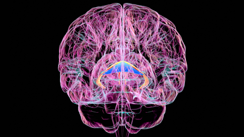 Brain Disorder Due to Vitamin Deficiency Often Goes Unrecognized