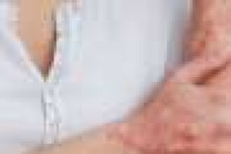 Big data analysis sheds light on psoriasis’s genetic code