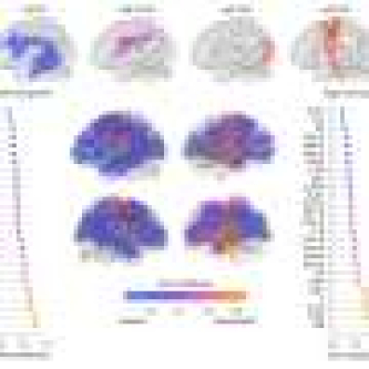 White matter ‘bridge’ bundles link brain hierarchy levels to broader mental functions